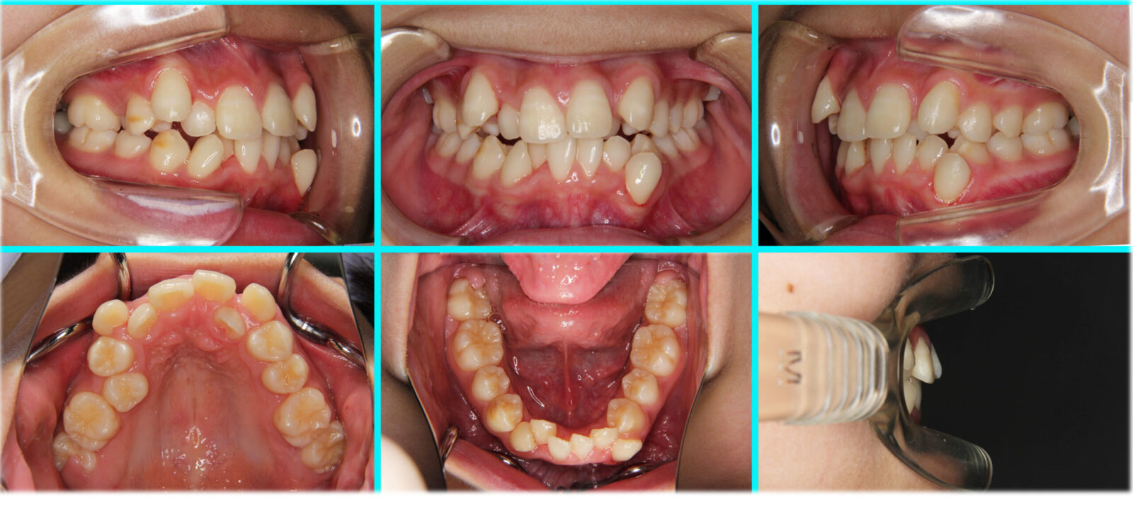 case_005_01-scaled.jpg