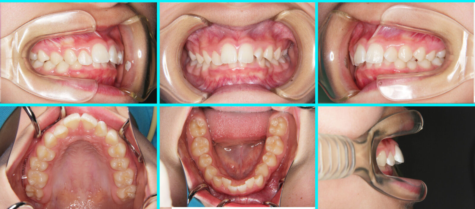 case_033_01-scaled.jpg