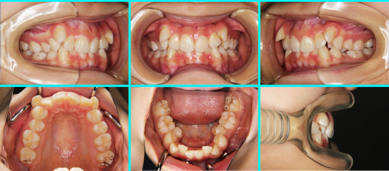 case_034_01-scaled.jpg