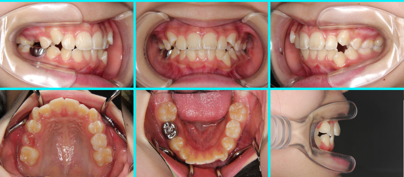 case_039_01-scaled.jpg