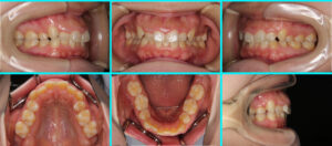 [50] 転院、再治療